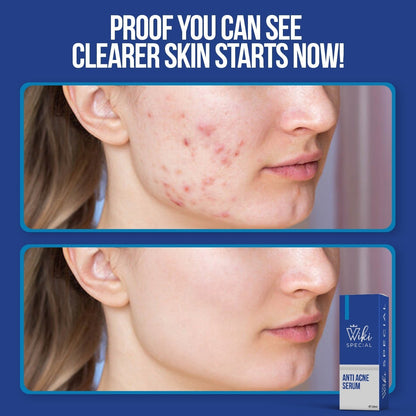 Wiki Special Serum